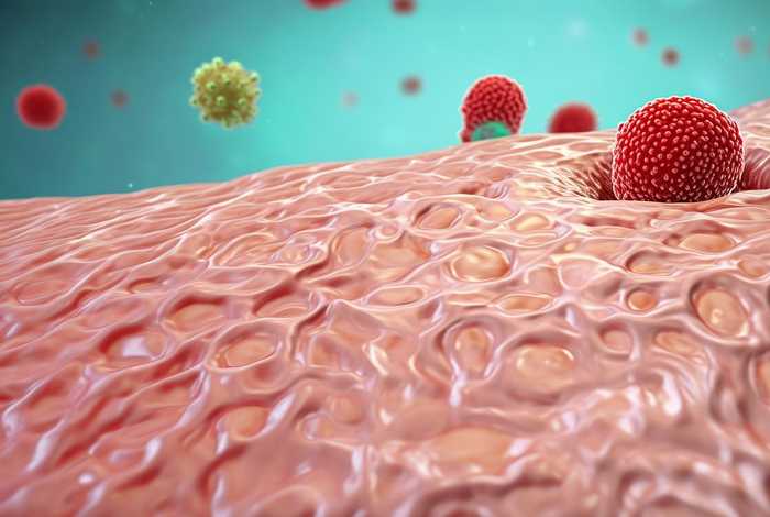 生殖疱疹是因什么引起、生殖疱疹是因什么引起图片 生殖疱疹是因什么引起、生殖疱疹是因什么引起图片