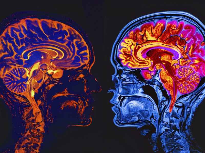 癫痫可以性生活吗、癫痫可以性生活吗男 癫痫可以性生活吗、癫痫可以性生活吗男