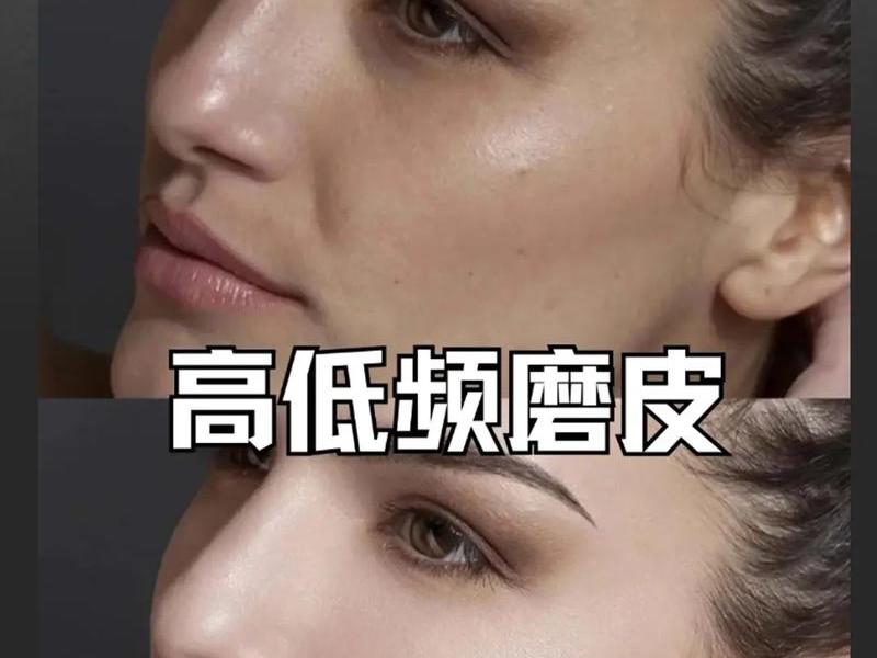 ps皮肤质感怎么修 - ps皮肤怎么修得有质感点 ps皮肤质感怎么修 - ps皮肤怎么修得有质感点