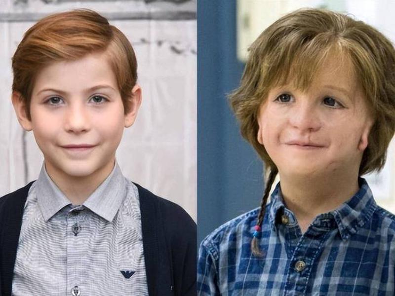 奇迹笨小孩人物解析(奇迹男孩的小演员是那个样子的吗?) 奇迹笨小孩人物解析(奇迹男孩的小演员是那个样子的吗?)