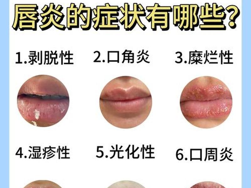 唇周紧绷是什么原因、唇周紧绷发痒是怎么回事