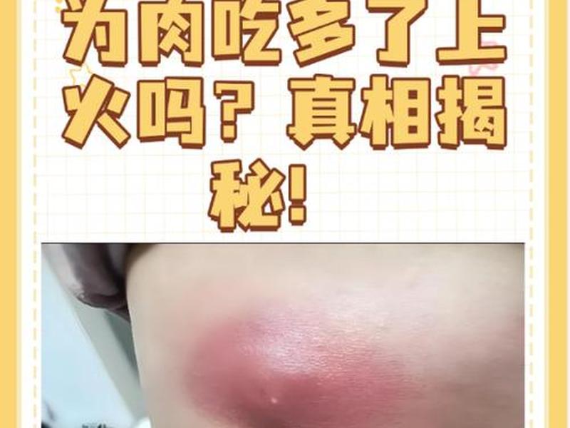 囊肿痘痘自己爆了流血(囊肿痘痘自己爆了流血怎么办) 囊肿痘痘自己爆了流血(囊肿痘痘自己爆了流血怎么办)