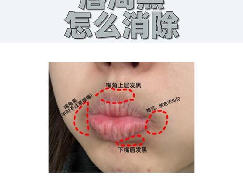 唇周皮肤受损怎么修复,唇周皮肤受损怎么修复图片 唇周皮肤受损怎么修复,唇周皮肤受损怎么修复图片