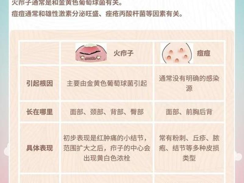 囊肿痘痘如何治疗;囊肿痘痘如何治疗图片 囊肿痘痘如何治疗;囊肿痘痘如何治疗图片