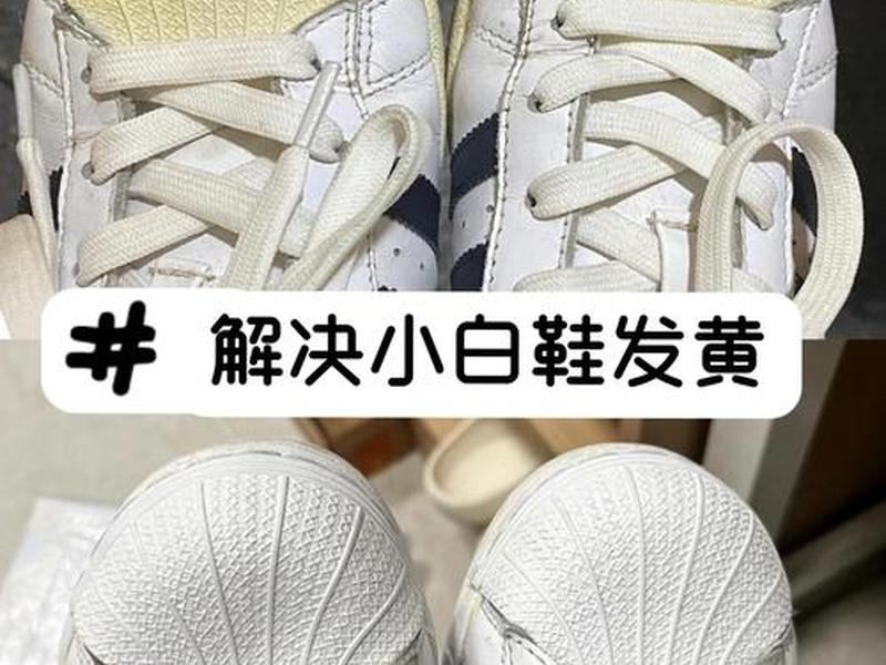匡威鞋帮发黄怎么变白妙招 - 匡威鞋帮发黄怎么变白妙招视频