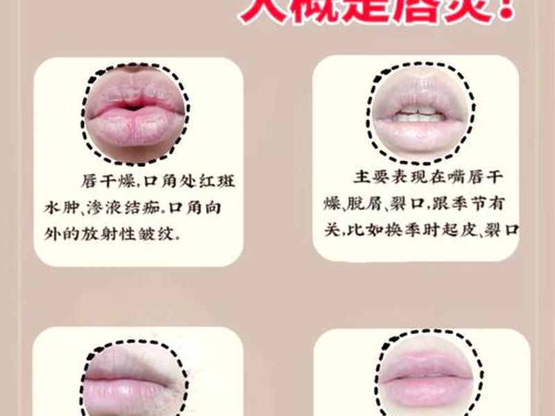 唇周松弛怎么处理人际关系 嘴周松弛怎么办 唇周松弛怎么处理人际关系 嘴周松弛怎么办
