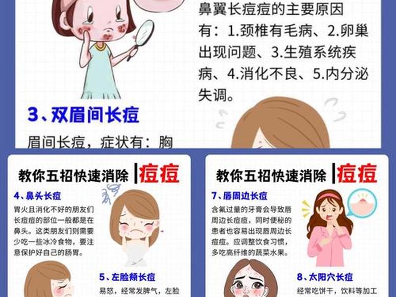 囊肿型痘痘消下去小妙招、囊肿型痘痘怎么消下去 囊肿型痘痘消下去小妙招、囊肿型痘痘怎么消下去