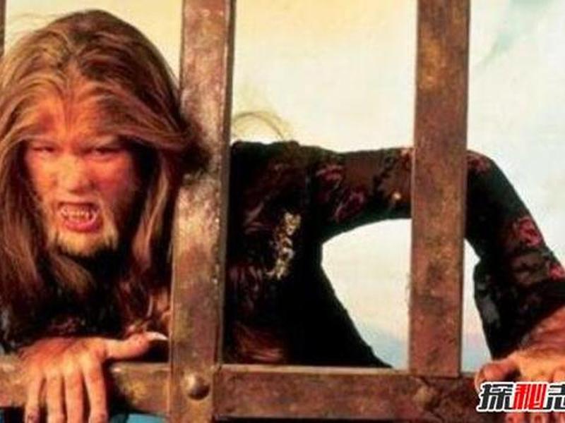 关于狼孩的真实案例，关于狼孩的真实案例视频