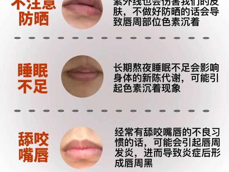 唇周松弛怎么处理人际关系 嘴周松弛怎么办 唇周松弛怎么处理人际关系 嘴周松弛怎么办