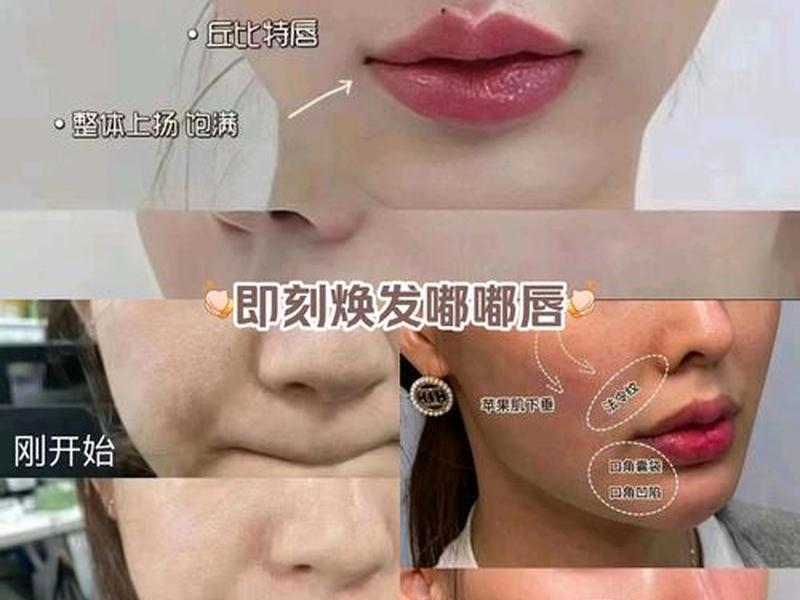 唇周老化松弛怎么改善、唇周老化松弛怎么改善图片 唇周老化松弛怎么改善、唇周老化松弛怎么改善图片