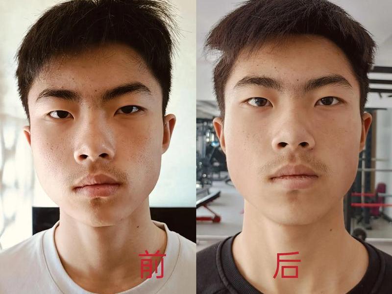 人成年之后面貌变化有多大 人成年之后面貌变化有多大了 人成年之后面貌变化有多大 人成年之后面貌变化有多大了