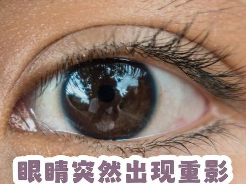 人喝酒后看东西模糊发黑;人喝酒后看东西模糊发黑是什么病 人喝酒后看东西模糊发黑;人喝酒后看东西模糊发黑是什么病