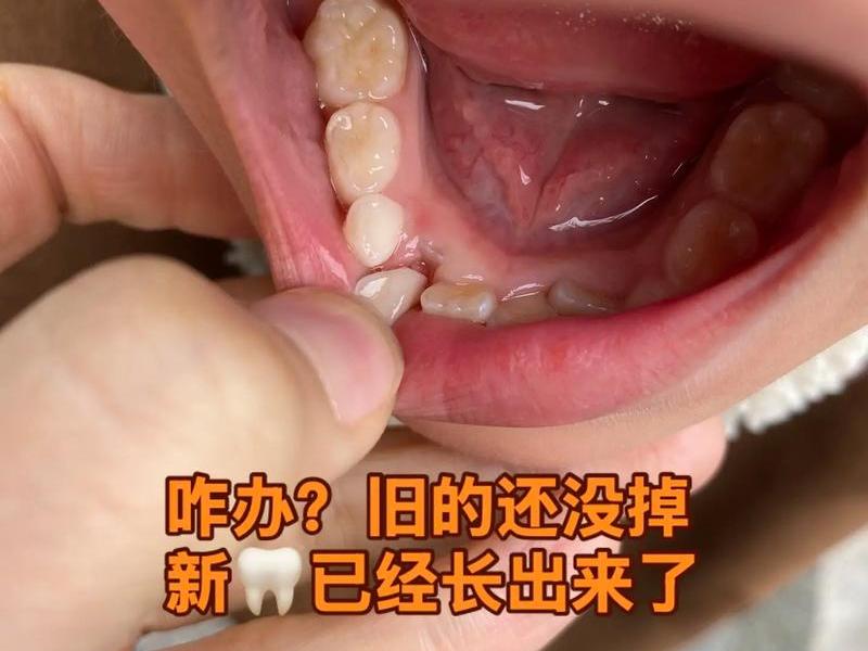 人的牙齿脱落还会长出来吗,人的牙齿脱落还会长出来吗视频 人的牙齿脱落还会长出来吗,人的牙齿脱落还会长出来吗视频