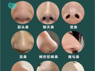 哪一种鼻子的人命运比较好；哪种鼻子命不好
