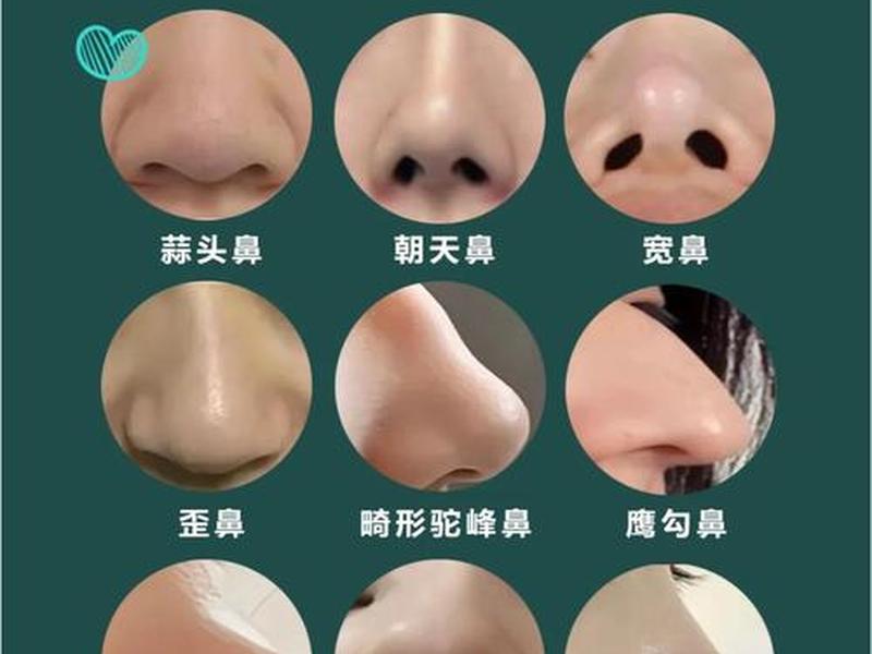哪一种鼻子的人命运比较好;哪种鼻子命不好 哪一种鼻子的人命运比较好;哪种鼻子命不好