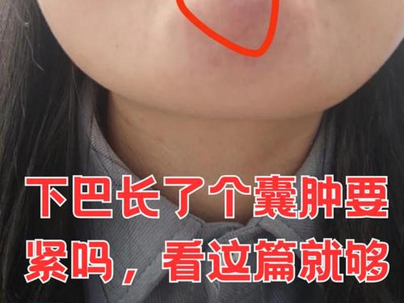 囊肿痘痘自己爆了流血(囊肿痘痘自己爆了流血怎么办) 囊肿痘痘自己爆了流血(囊肿痘痘自己爆了流血怎么办)