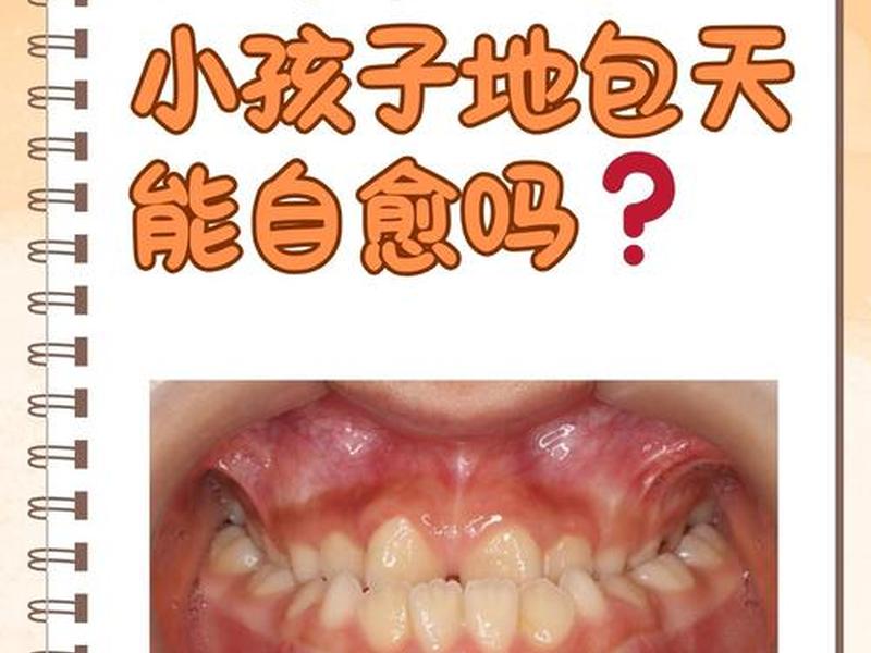 7岁孩子的牙齿上面会包住下面一点么 - 7岁孩子上牙包下牙 7岁孩子的牙齿上面会包住下面一点么 - 7岁孩子上牙包下牙