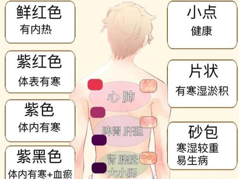 刮痧心理作用、刮痧心理作用是什么 刮痧心理作用、刮痧心理作用是什么