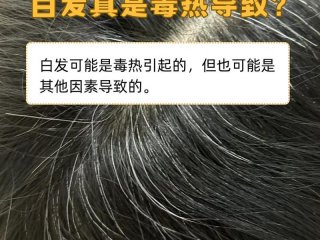40岁以后白发蹭蹭的往上冒出来 40岁以后白发蹭蹭的往上冒出来是什么病