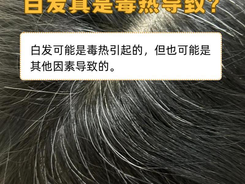 40岁以后白发蹭蹭的往上冒出来 40岁以后白发蹭蹭的往上冒出来是什么病 40岁以后白发蹭蹭的往上冒出来 40岁以后白发蹭蹭的往上冒出来是什么病