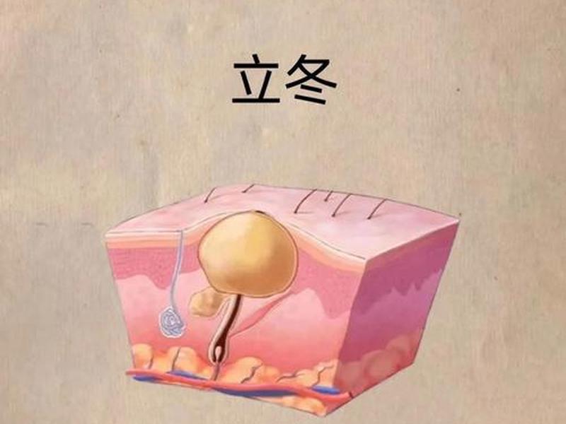 囊肿痘痘怎么好;囊肿的痘痘怎么好 囊肿痘痘怎么好;囊肿的痘痘怎么好