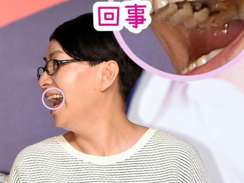 7岁孩子的牙齿上面会包住下面一点么 - 7岁孩子上牙包下牙 7岁孩子的牙齿上面会包住下面一点么 - 7岁孩子上牙包下牙