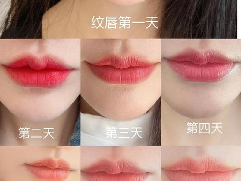 唇周皮肤受损怎么修复,唇周皮肤受损怎么修复图片 唇周皮肤受损怎么修复,唇周皮肤受损怎么修复图片