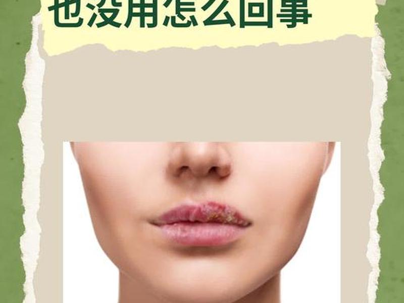 唇周干燥紧绷怎么解决 唇周干裂紧绷怎么处理 唇周干燥紧绷怎么解决 唇周干裂紧绷怎么处理