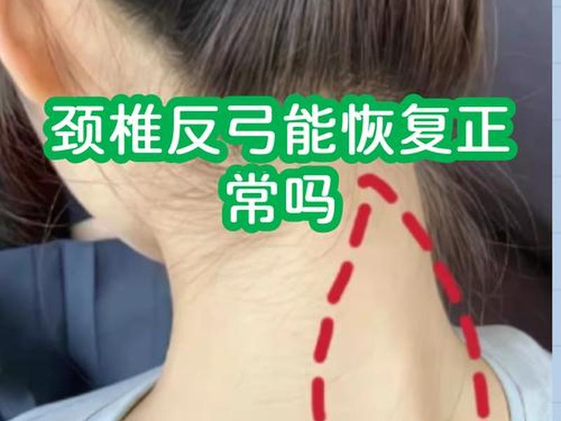 低头族的现象与建议(低头族现象的看法和建议) 低头族的现象与建议(低头族现象的看法和建议)
