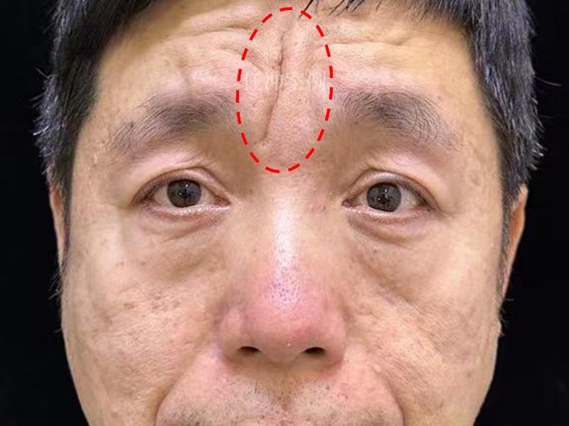 不懂感恩的男人面相,不懂感恩的男人面相分析 不懂感恩的男人面相,不懂感恩的男人面相分析
