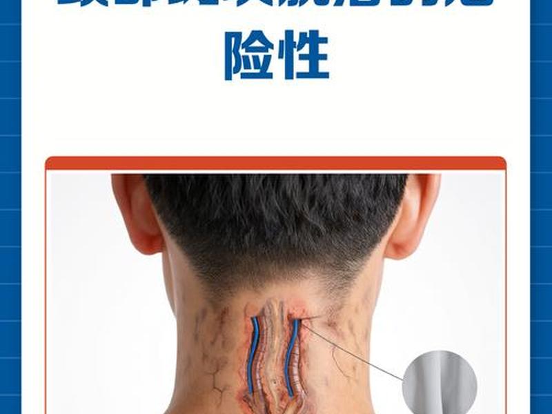 10个人九个人有颈部斑块;10个人九个人有颈部斑块主动脉斑块 10个人九个人有颈部斑块;10个人九个人有颈部斑块主动脉斑块