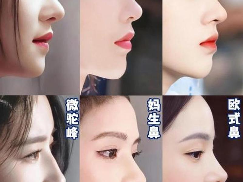 哪种鼻子好;哪种鼻子好看漂亮排行 哪种鼻子好;哪种鼻子好看漂亮排行