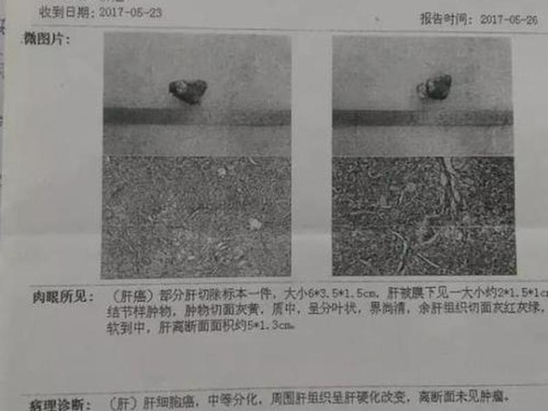 人保财险人伤高级核赔师库 人身险核保理赔中级考试试题 人保财险人伤高级核赔师库 人身险核保理赔中级考试试题