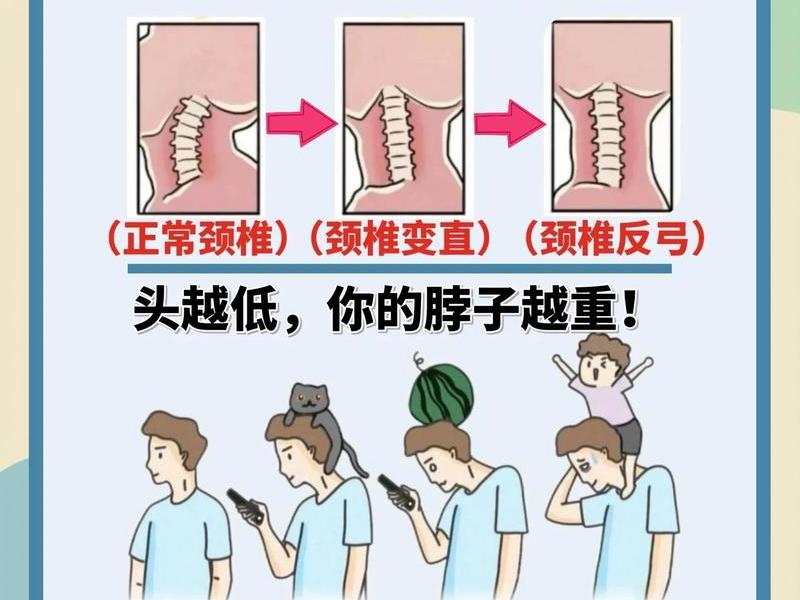 低头的影响,低头对身体的影响 低头的影响,低头对身体的影响
