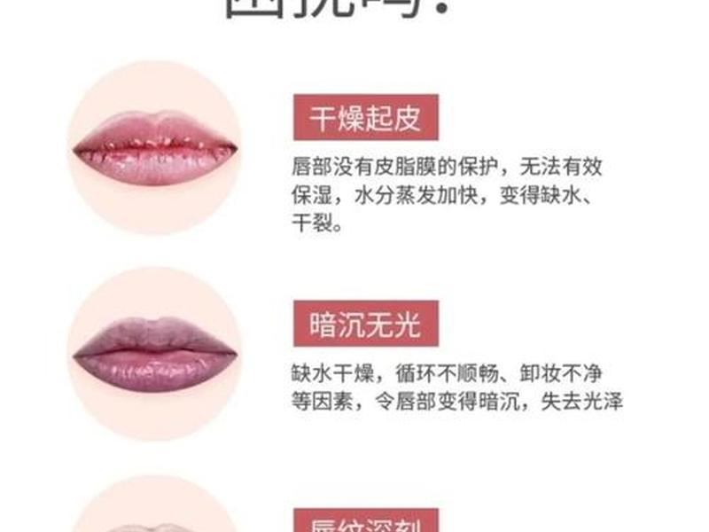 唇周干燥紧绷怎么解决 唇周干裂紧绷怎么处理 唇周干燥紧绷怎么解决 唇周干裂紧绷怎么处理