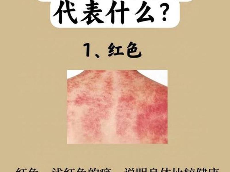 刮痧起到什么样的效果(刮痧起到什么样的效果呢) 刮痧起到什么样的效果(刮痧起到什么样的效果呢)