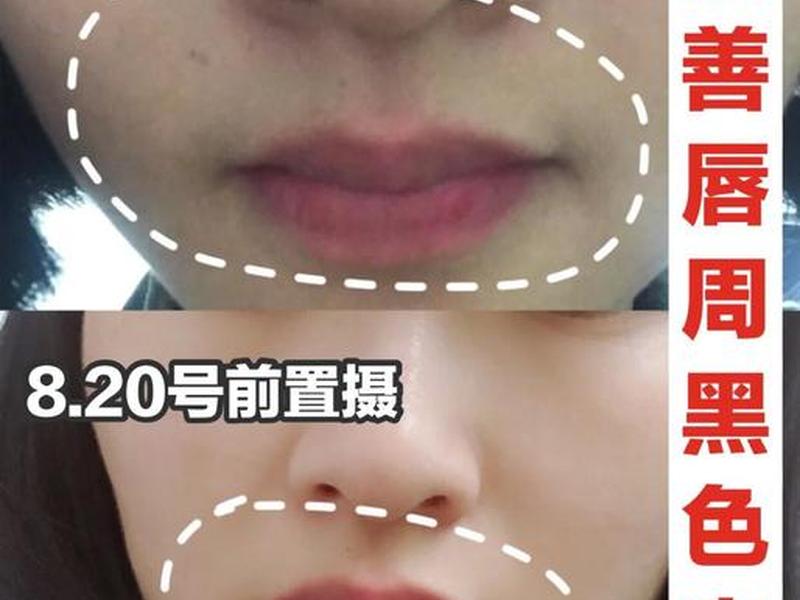 唇周暗沉怎么改善小妙招;唇周暗沉发黄怎么改善 唇周暗沉怎么改善小妙招;唇周暗沉发黄怎么改善