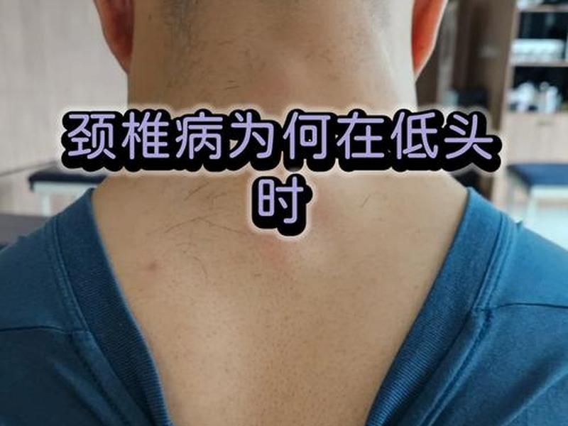 低头症的危害 - 低头症的危害有哪些 低头症的危害 - 低头症的危害有哪些