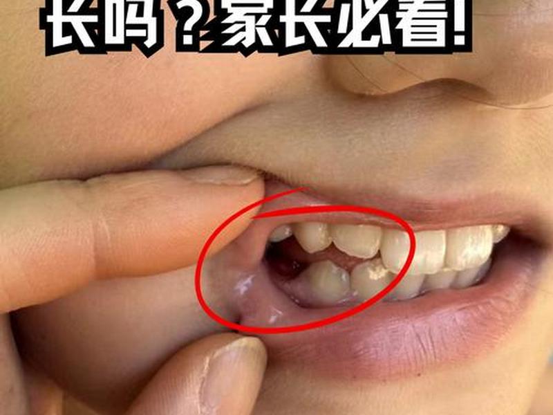 人的牙齿脱落还会长出来吗,人的牙齿脱落还会长出来吗视频 人的牙齿脱落还会长出来吗,人的牙齿脱落还会长出来吗视频
