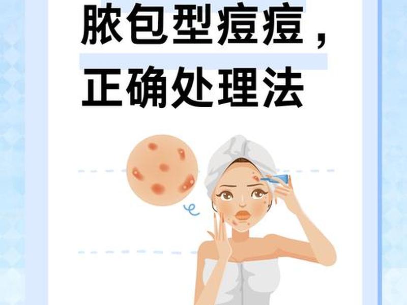 囊肿痘痘怎么处理人际关系、囊肿行痘痘怎么处理 囊肿痘痘怎么处理人际关系、囊肿行痘痘怎么处理