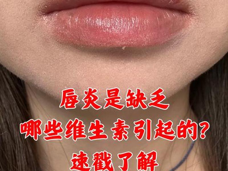 唇周感觉异常;唇周有点痛 唇周感觉异常;唇周有点痛